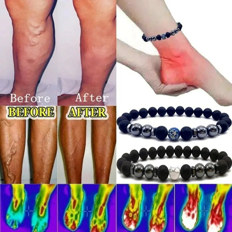 2022 Treatment of Varicose Veins Obsidian Anklet Adjustable Weight Loss Magnetic Therapy Magnet Anklet Bracelet for Mom Dad
